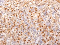 Staining with mouse monoclonal ACTH [Clone 2F6] antibody in formalin-fixed paraffin-embedded human pituitary gland.